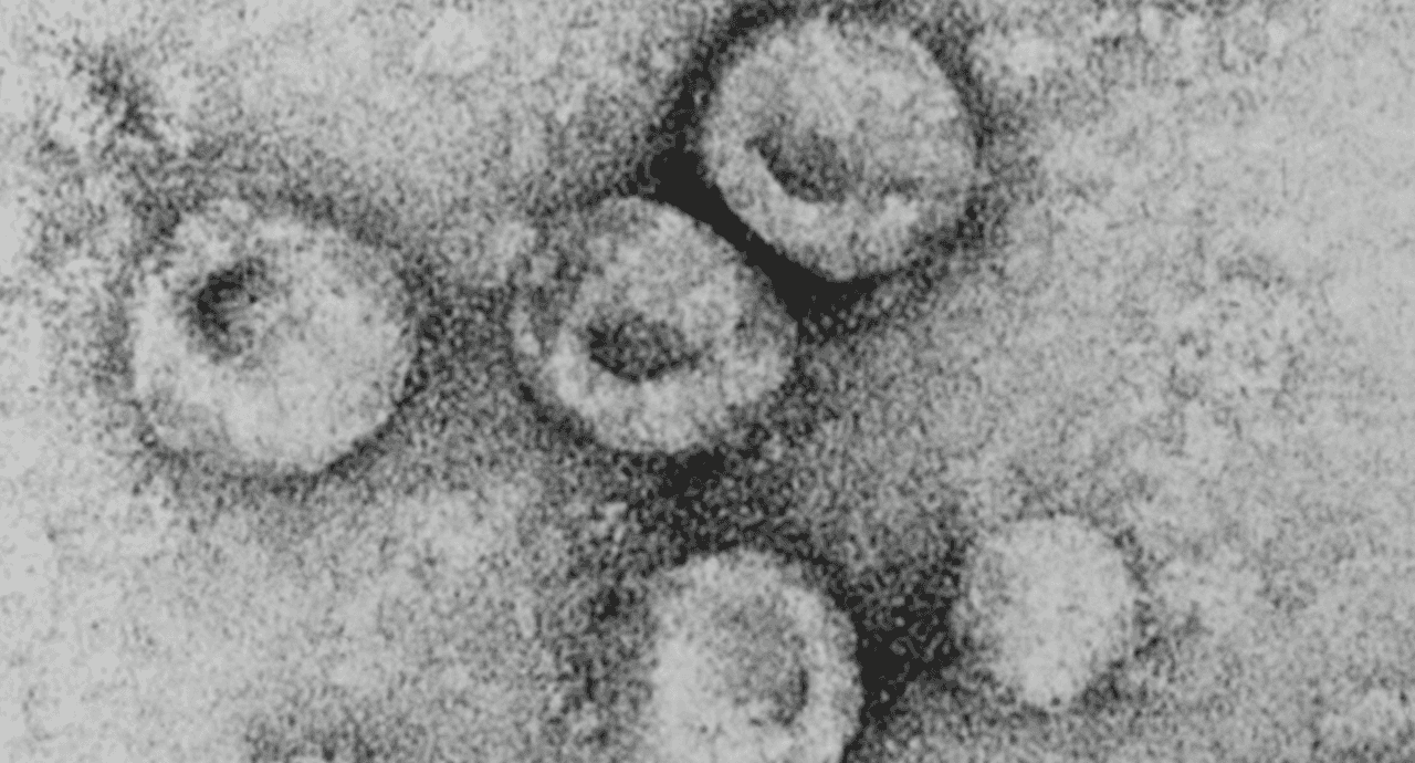 Bovine viral diarrhea virus 1