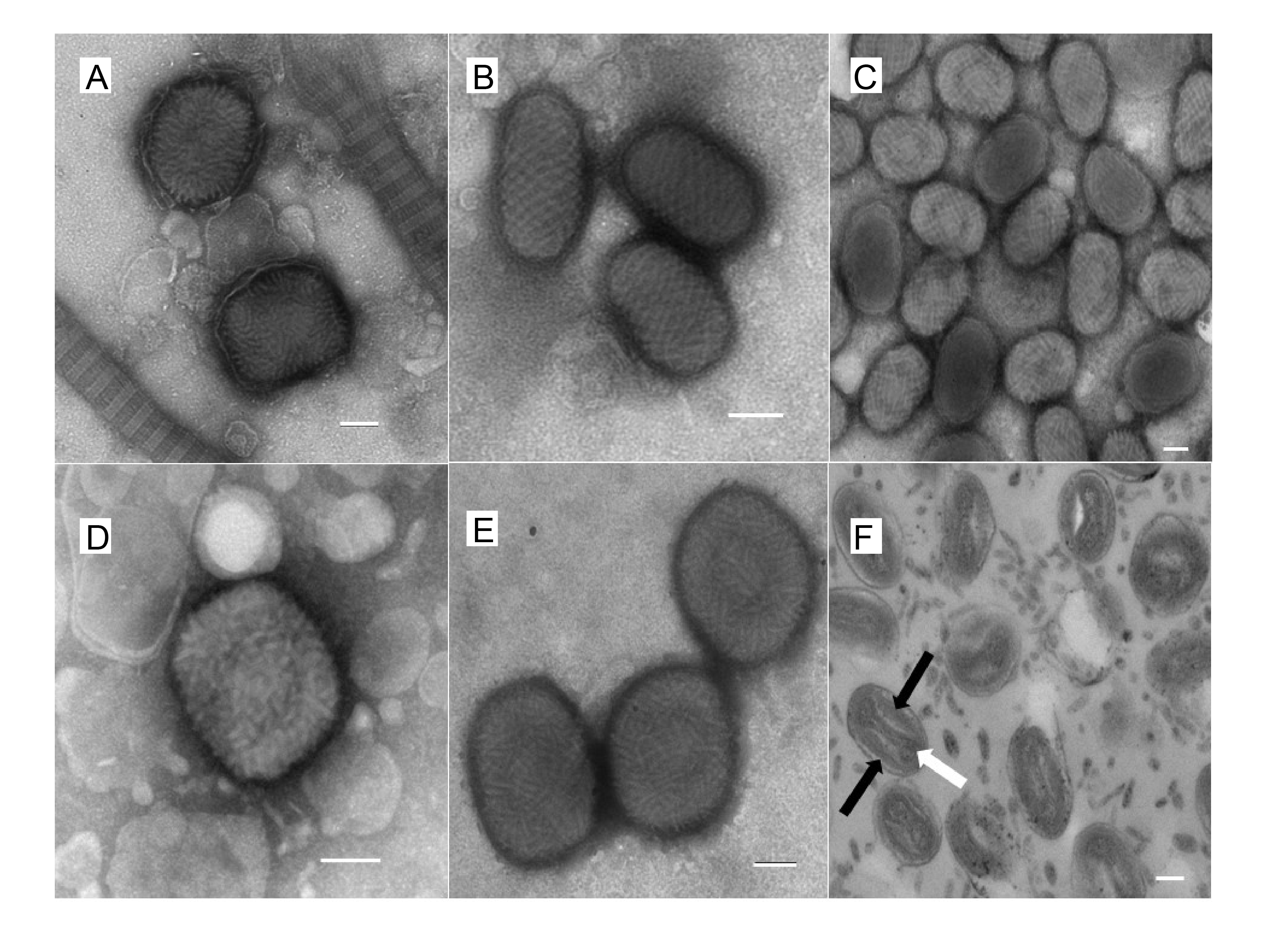 Poxviridae virions