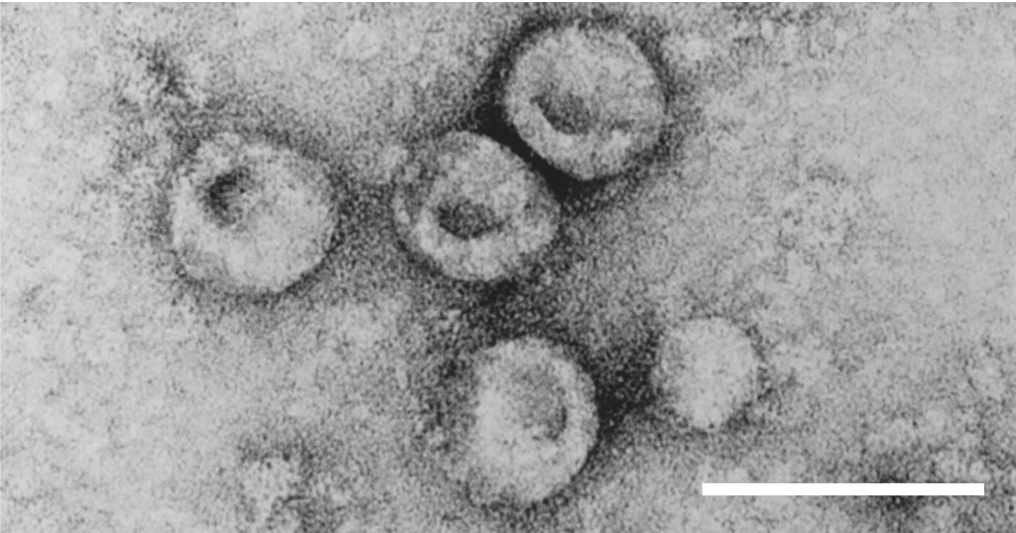 bovine viral diarrhea virus 1