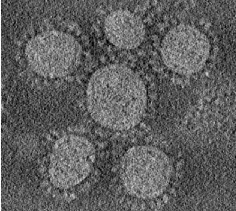 Coronaviridae: virion EM