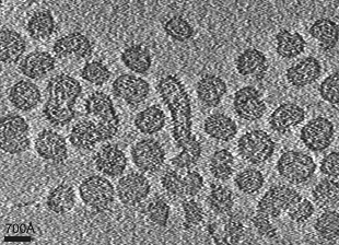 Matonaviridae