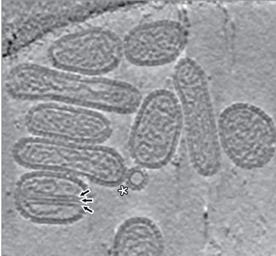 Hantaviridae