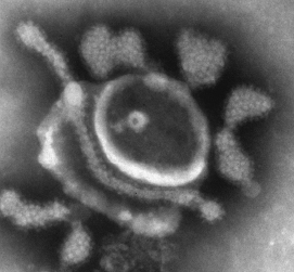 Tosoviridae