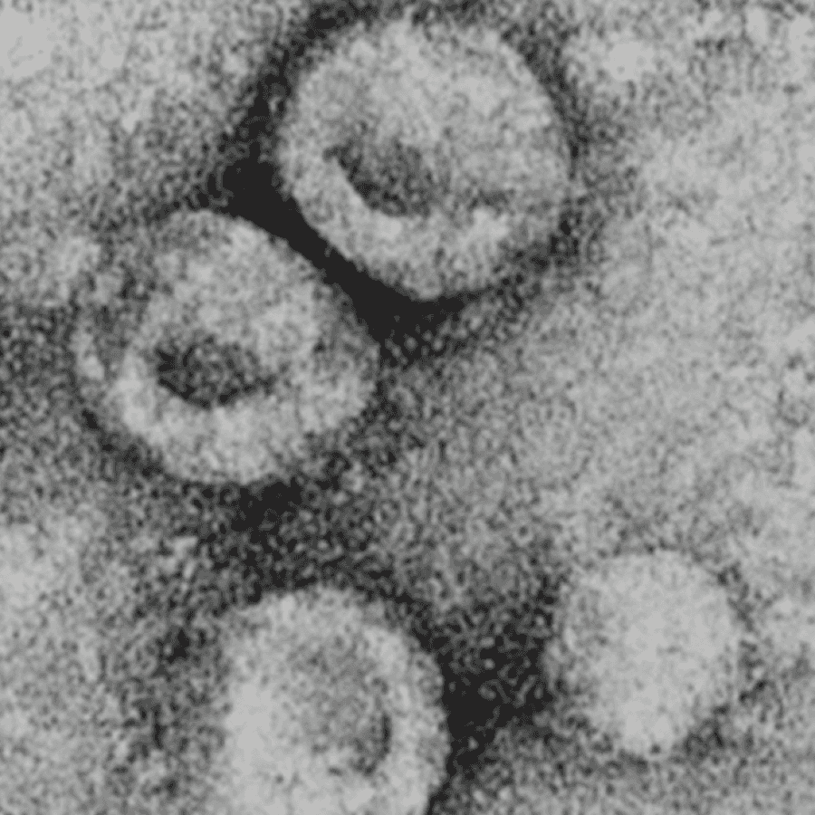 Bovine viral diarrhea virus 1