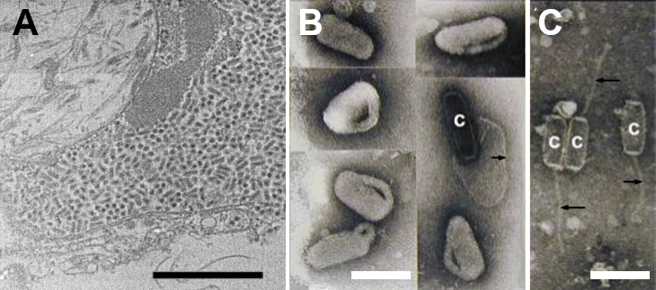 Alphanudivirus virion EM