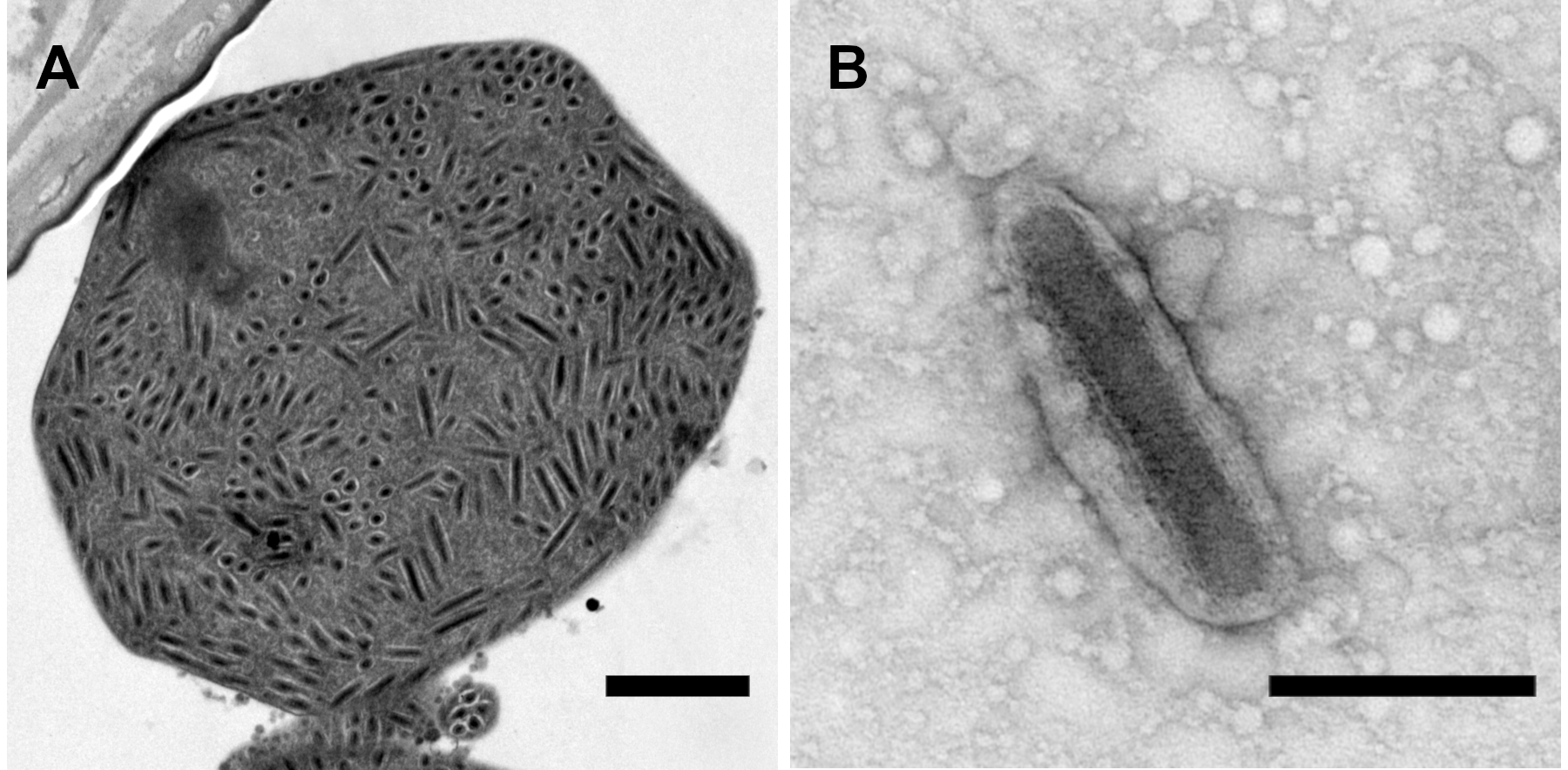 Betabduvirus virions