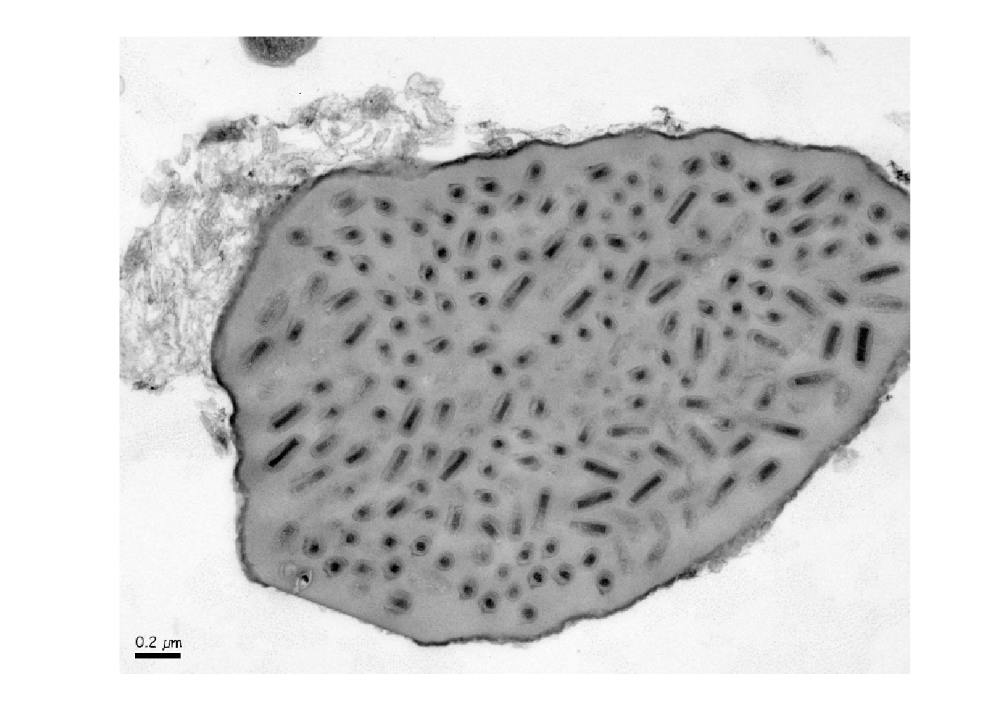 Deltanudivirus virions