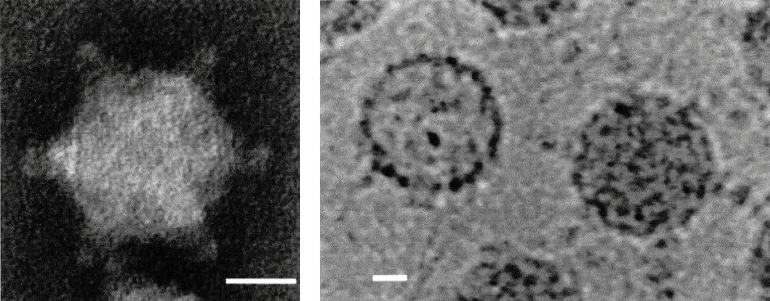 Figure 1. Cypovirus