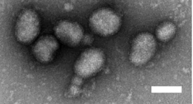 Feravirus virions