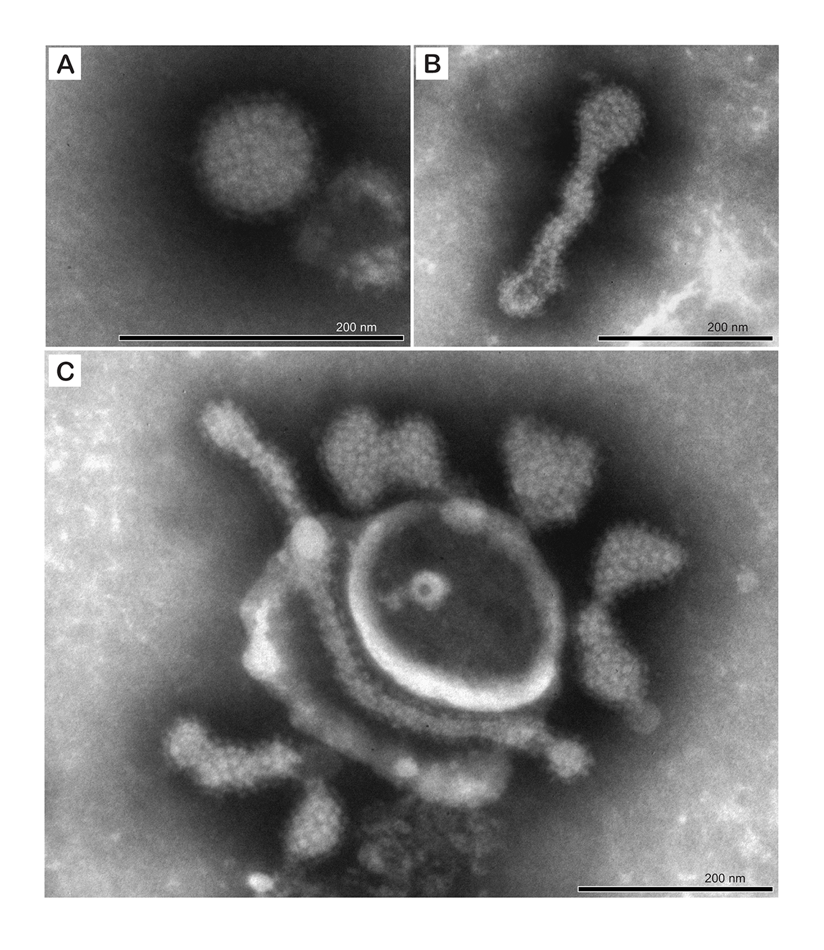 Tosoviridae virion EM